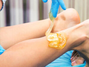 Sugaring hair removal